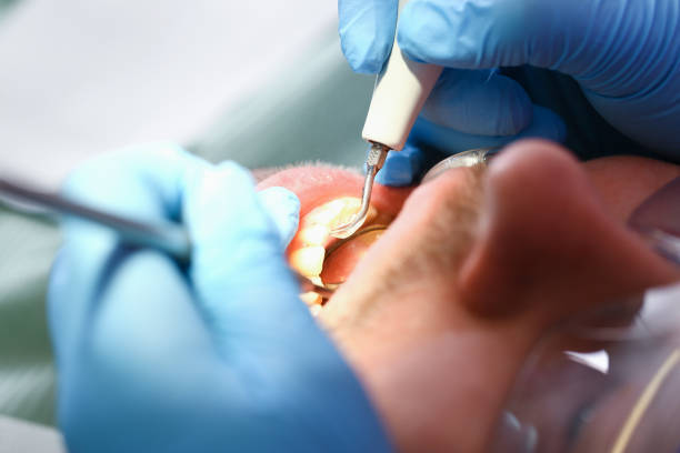 Best Emergency Dentist for Lost Fillings or Crowns in Mcrae Helena, GA