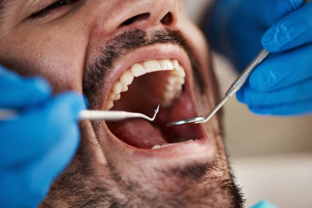 Best Emergency Dental Services for Seniors in Mcrae Helena, GA